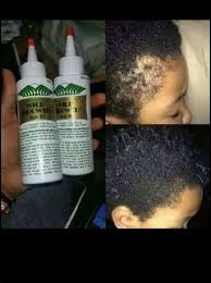 wild growth hair oil kenya wild growth hair oil wild growth hair oil reviews wild growth hair oil jumia wild growth hair oil ingredients wild growth hair oil for edges wild growth hair oil side effects wild growth hair oil in Nairobi Nairobi Kenya daresalaam tanzania juba south sudan Khartoum sudan Kigali Rwanda kampala Uganda bunjumbura Burundi kinshasaDRC glutathione injections Maputo Mozambique accra Ghana Dakar Senegal Lusaka Zambia Monrovia angola jibouti asmara Eritrea tunis Tunisia rabat morocco cairo Egypt Harare zimbambwe varicose veins treatment Mauritius Seychelles Pretoria south Africa glutathione shop lagos Nigeria hair growth and baldness products shop capeverde eguitorial guinea mogadishu Somalia adisababa Ethiopia togo Liberia sierraleone varicofix cream shop africa +254723408602