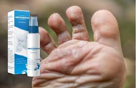 Foot Care, Feet And Nails Care Products, Skin Care Products In Kenya, Toe Nails Care Products, Itching Feet Products