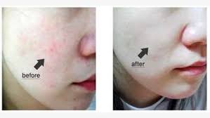  Slim Tea Pro in Nairobi CBD , Cinci Brido Whitening Cream