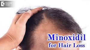 shop Best hip boosters in kenya, Minoxidil Hair Regrowth Solution