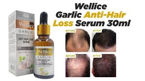 Collagen For Bones, Wellice Garlic Anti-Hair Loss