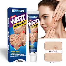 where to buy Ecoslim slimming capsules in nairobi, HBESTY Warts Remover Cream