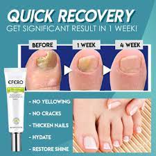 buy Wins Town Ulcer Solution Tea At Best Prices In Kenya, Efero Nail Treatment Gel